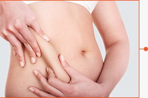 Stomach with belly fat before photo - tummy tuck albany ny