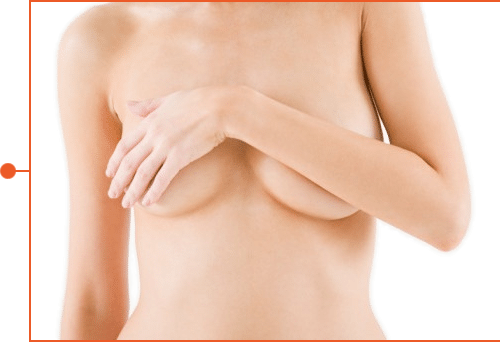 Before breast lift surgery in Albany NY - breast lift albany ny
