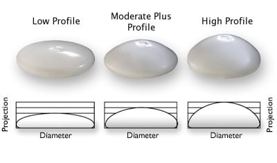 Breast Q&A: Will High Profile Breast Implants or Moderate Plus Give Me Natural Looking Breasts? Breast implant profiles: high profile vs moderate vs moderate plus
