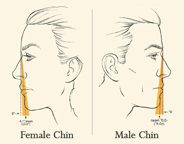 Chin Augmentation Example (Male & Female) Chin Augmentation Example (Male & Female)