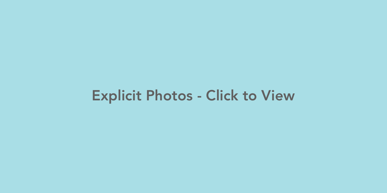 24 y/o Labiaplasty and Clitoral Hood Reduction