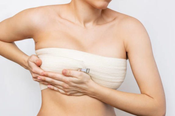 a photo of a patient post breast procedure