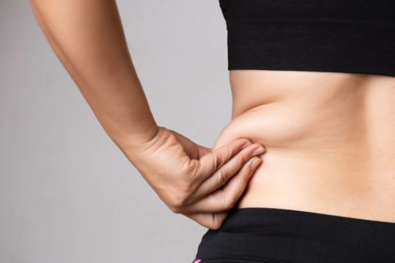 a candidate for liposuction or tummy tuck