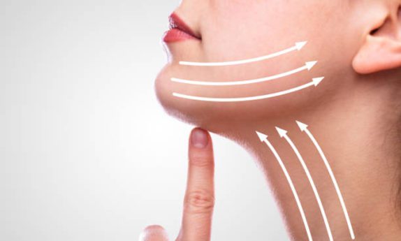 a diagram showing the effects of a necklift, one of the most popular procedures in cosmetic surgery