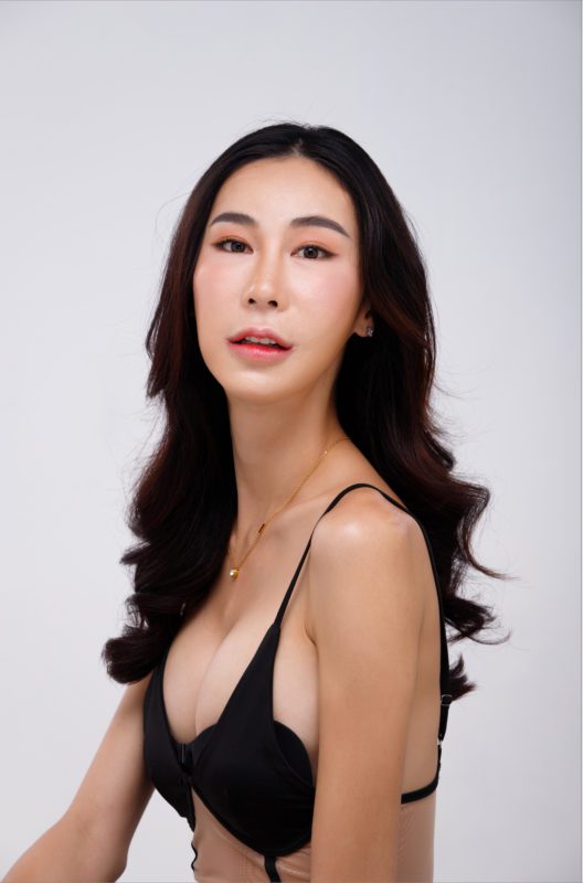 a ftm transgender top surgery candidate looking at the camera wearing black